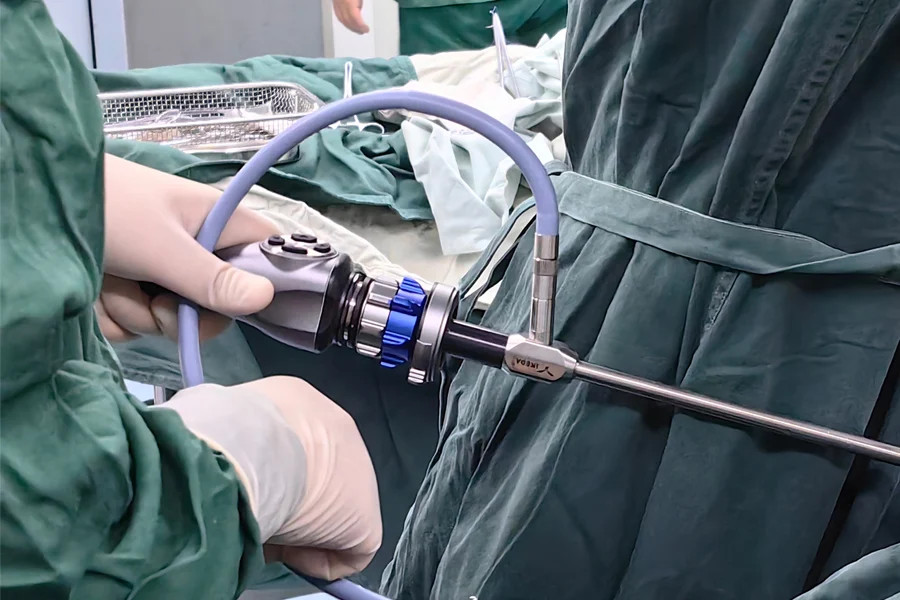  Laparoscopic Varicocelectomy 