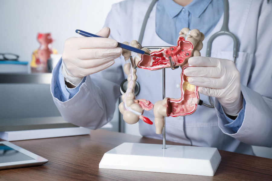 Colon surgeries