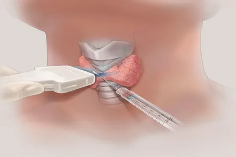 Neck surgeries