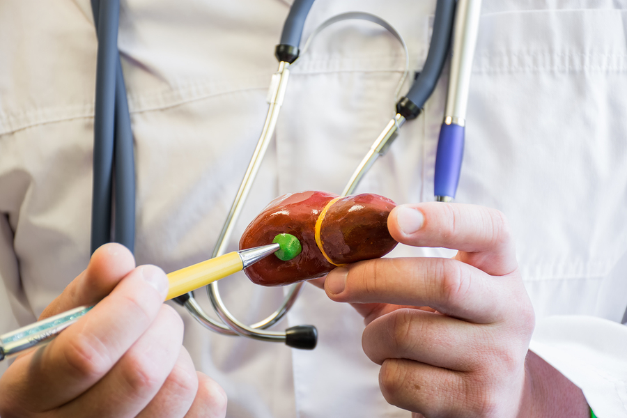  Cholecystectomy 